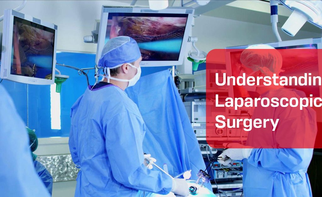 Laparoscopic Surgery