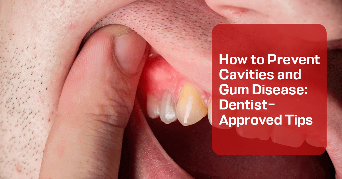 Prevent Cavities and Gum Disease