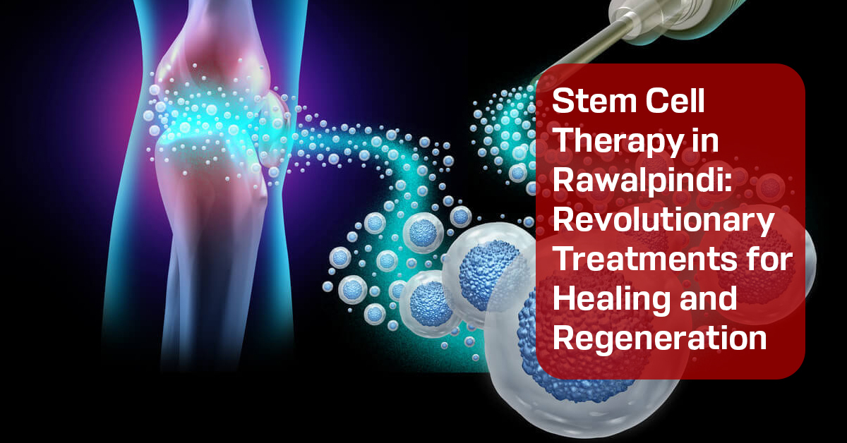 Stem Cell Therapy in Rawalpindi