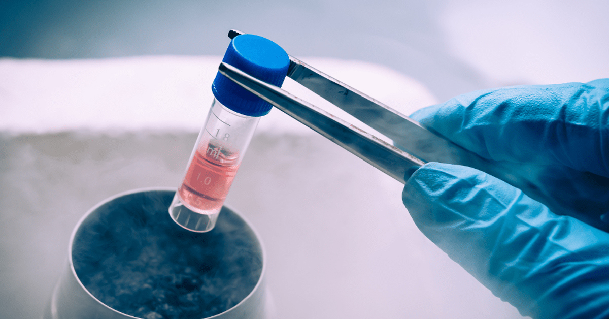 Stem Cell Therapy in Rawalpindi