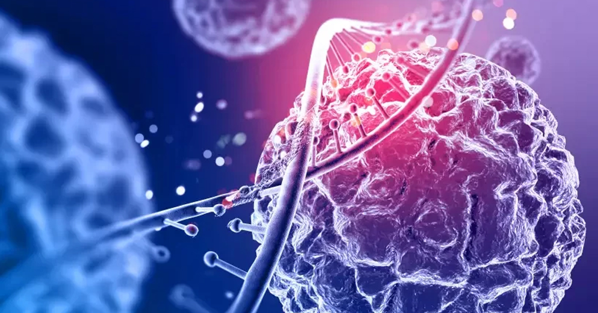 Stem Cell Therapy in Rawalpindi