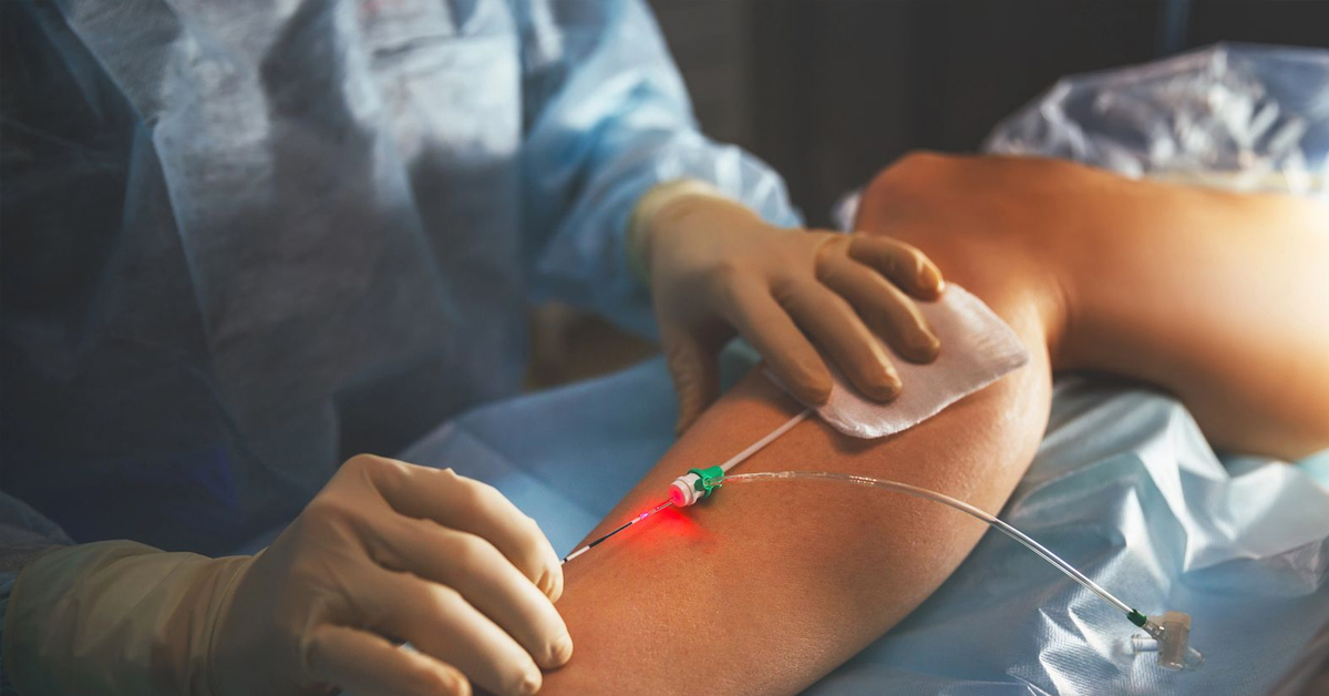 Vascular Surgery in Rawalpindi