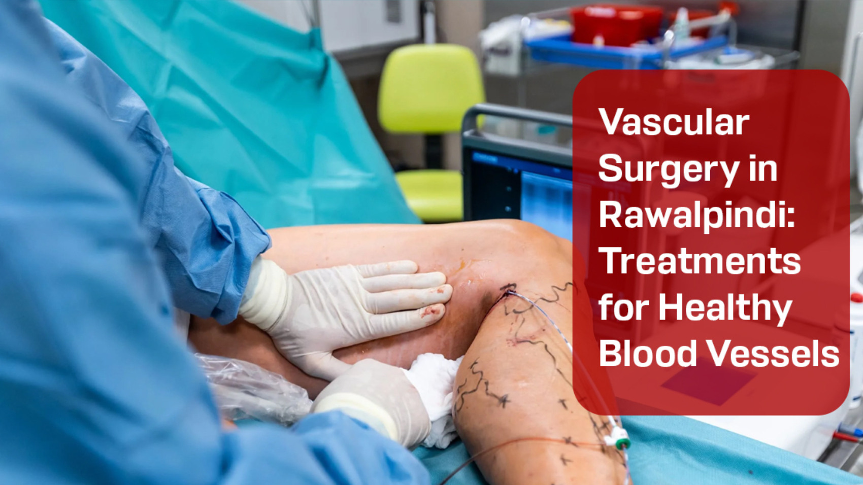Vascular Surgery in Rawalpindi