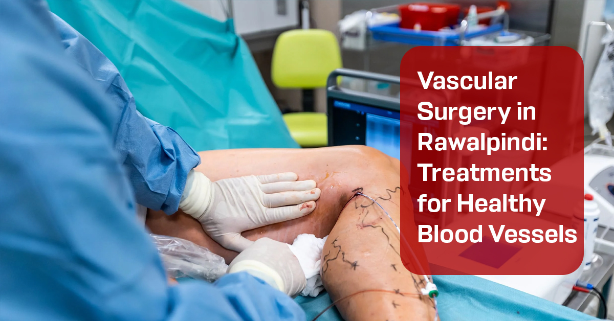 Vascular Surgery in Rawalpindi